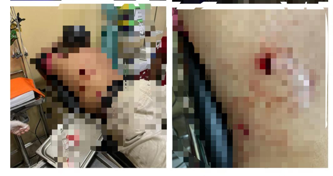 POLSEK CIJERUK CEK LOKASI TKP DAN INVESTIGASI PENYELIDIKAN LANJUT TERKAIT PERKARA DUGAAN TINDAK PIDANA SECARA BERSAMA – SAMA LAKUKAN KEKERASAN DENGAN MENGGUNAKAN SENJATA TAJAM