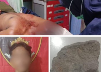 Polsek Cabangbungin Ungkap Kasus Pengeroyokan, Satu Tersangka Diamankan